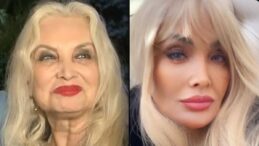 Orhan Gencebay’ın hayat arkadaşı Sevim Emre’den filtre iddialarına cevap verdi: